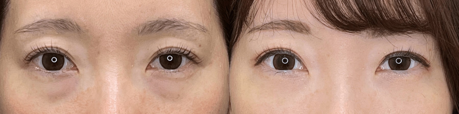 ベスト症例写真