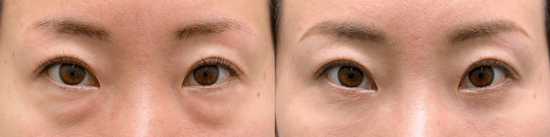 ベスト症例写真