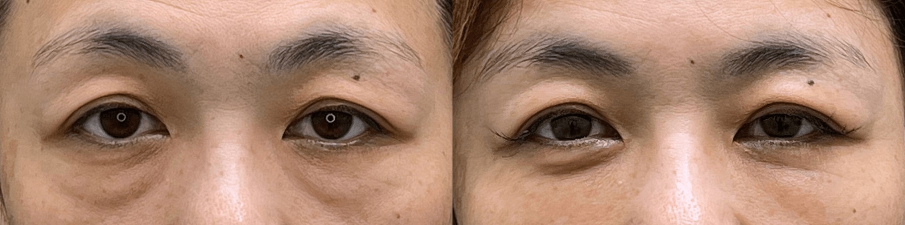 ベスト症例写真