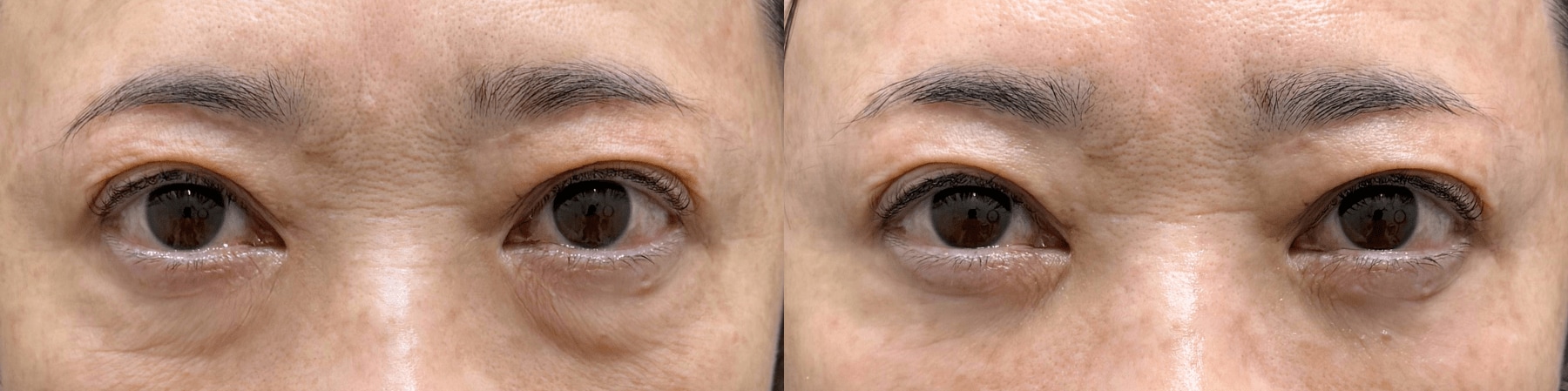 ベスト症例写真