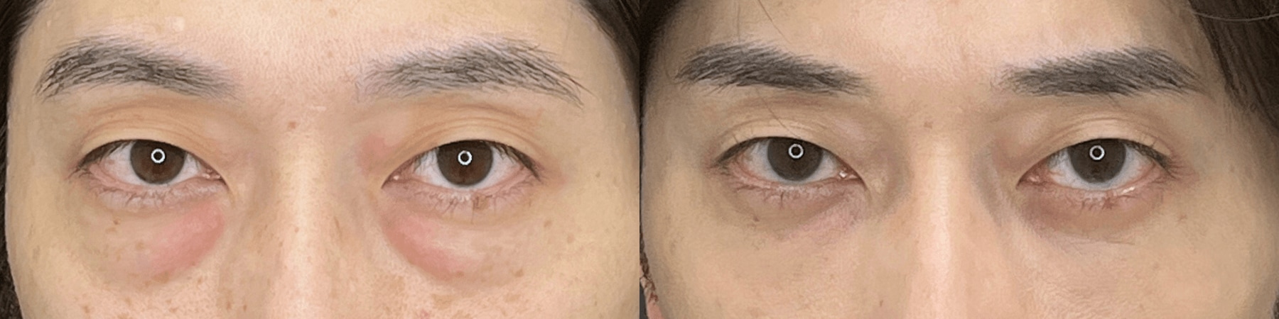 ベスト症例写真