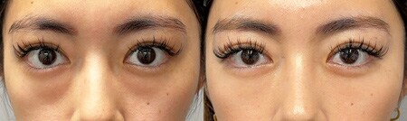 ベスト症例写真