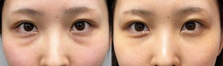 ベスト症例写真