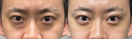 ベスト症例写真