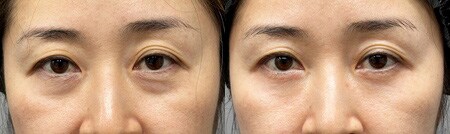 ベスト症例写真