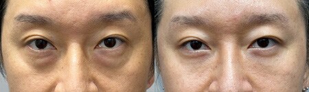 ベスト症例写真