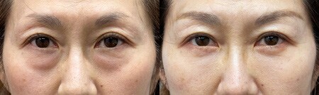 ベスト症例写真