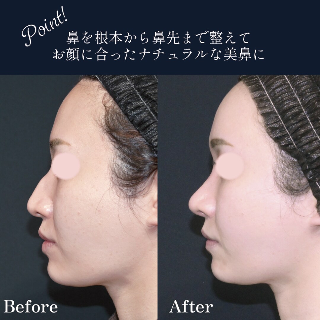 ベスト症例写真