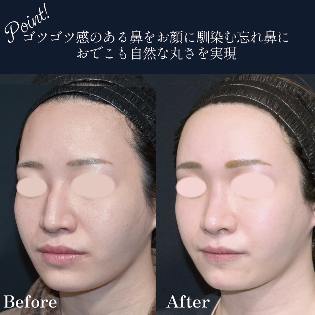 ベスト症例写真