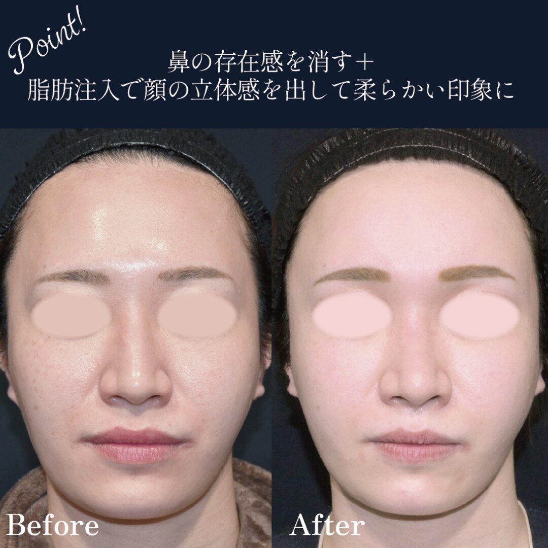 ベスト症例写真