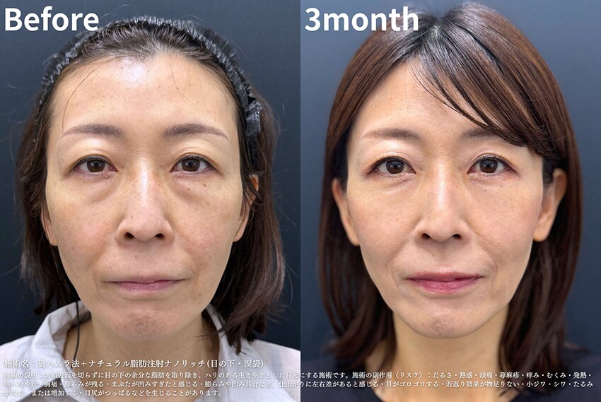 ベスト症例写真