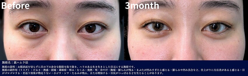 ベスト症例写真