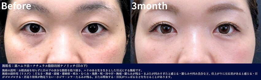 ベスト症例写真