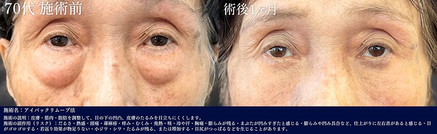 ベスト症例写真