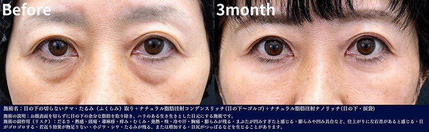 ベスト症例写真