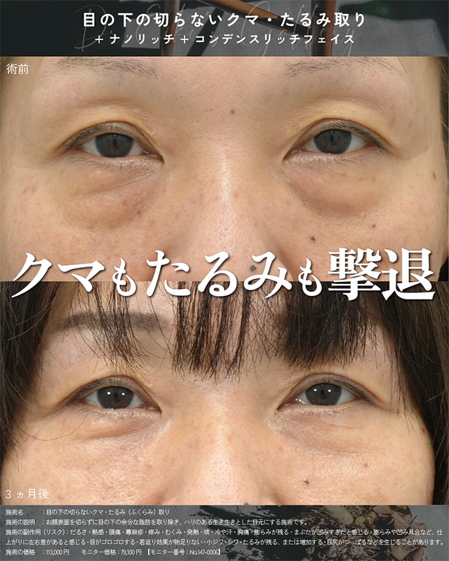 ベスト症例写真