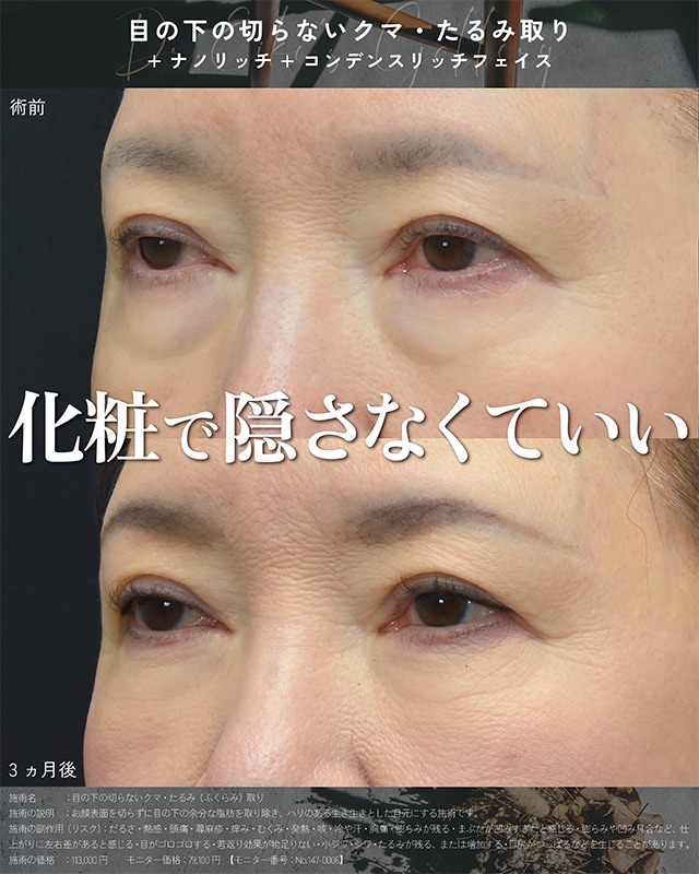 ベスト症例写真