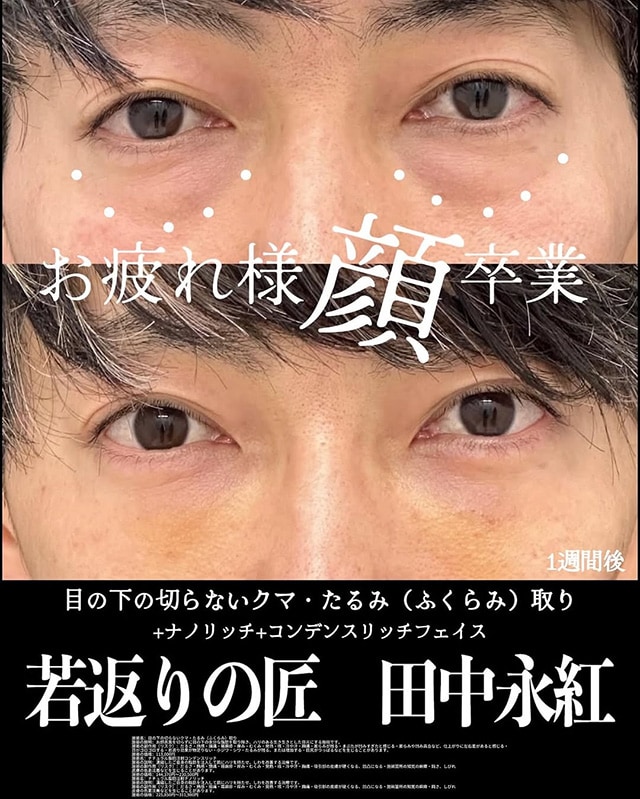 ベスト症例写真