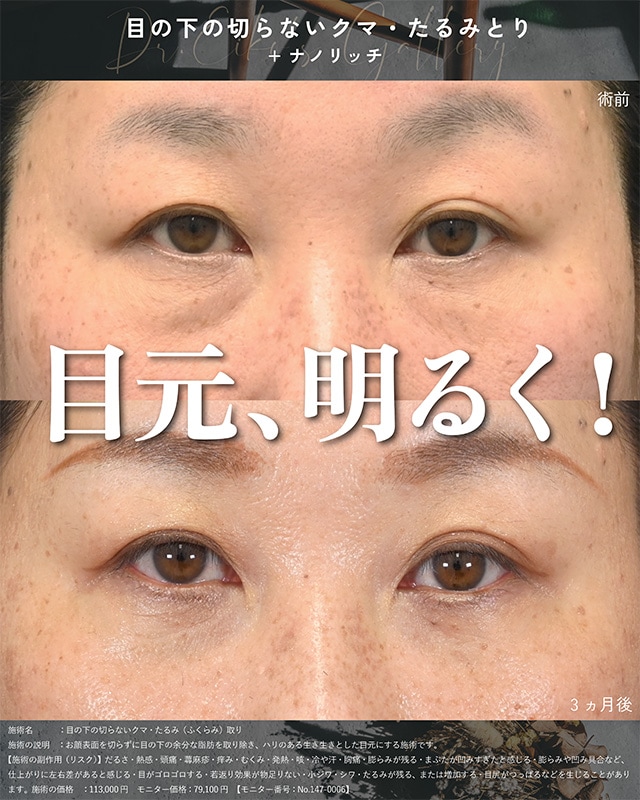 ベスト症例写真