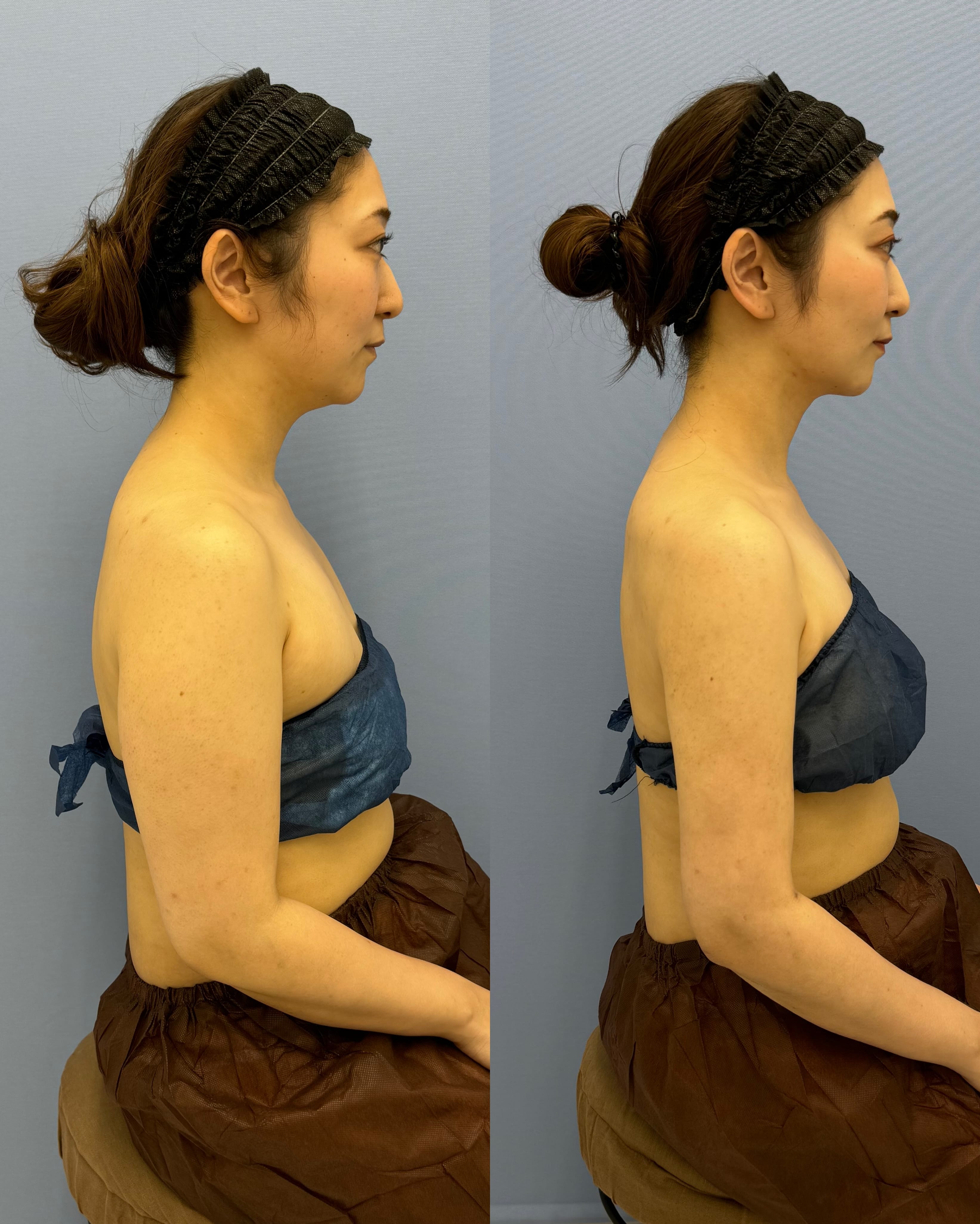 ベスト症例写真