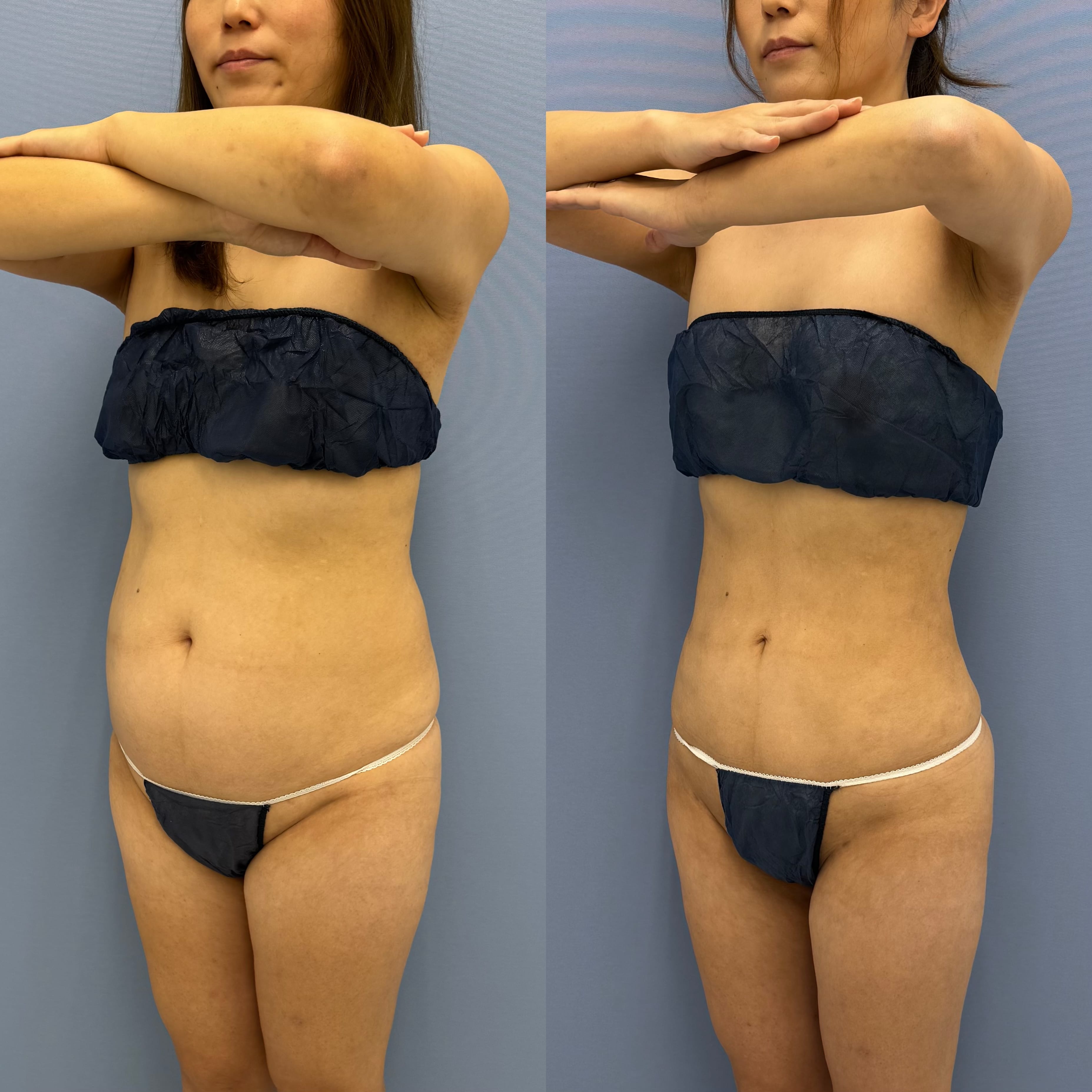 ベスト症例写真