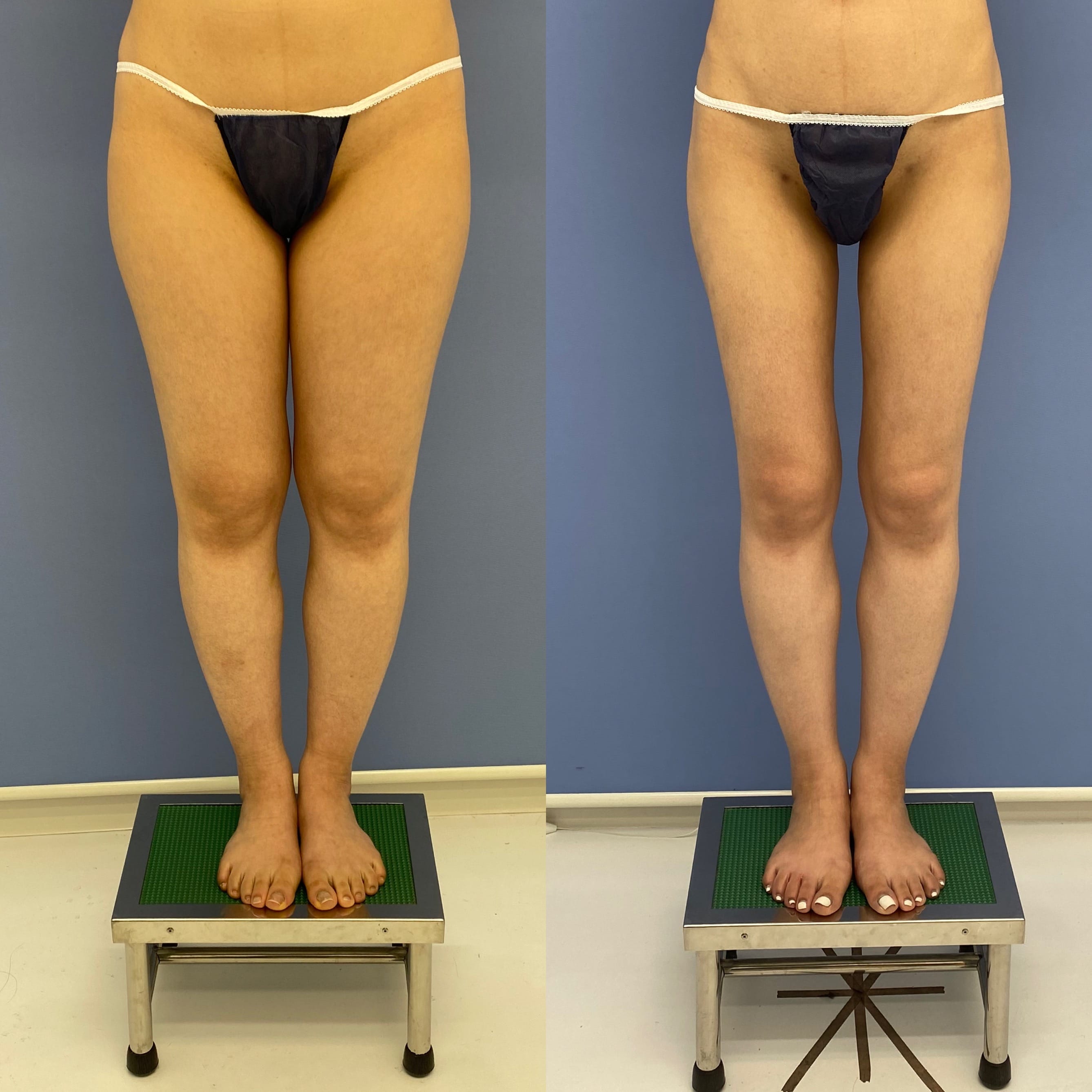 ベスト症例写真