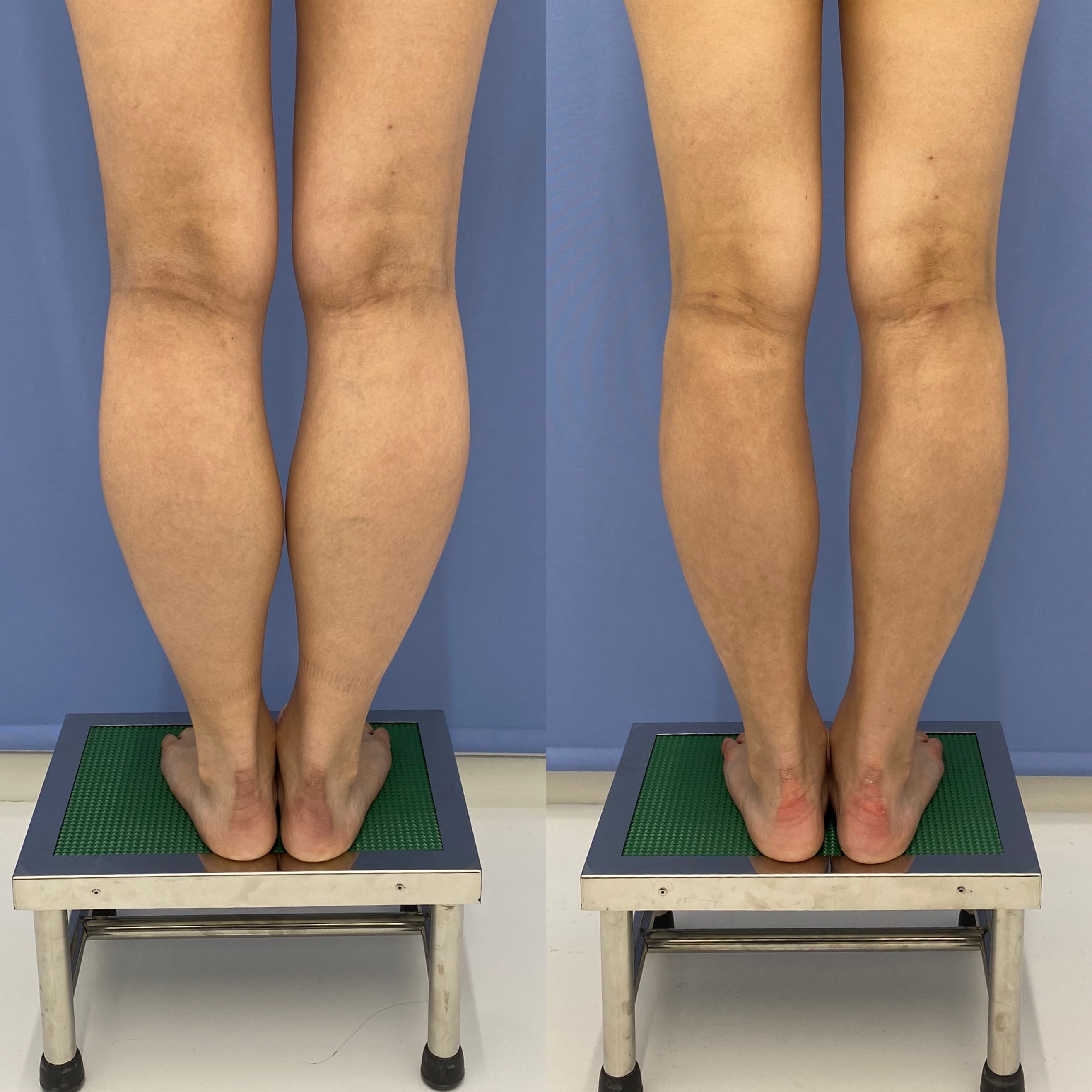 ベスト症例写真