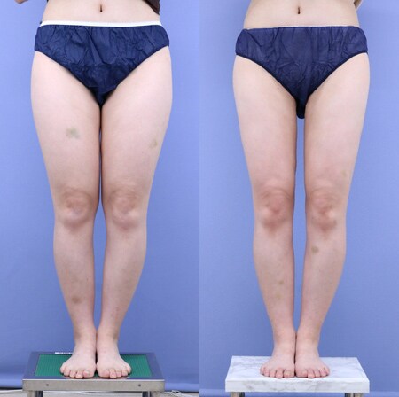 ベスト症例写真