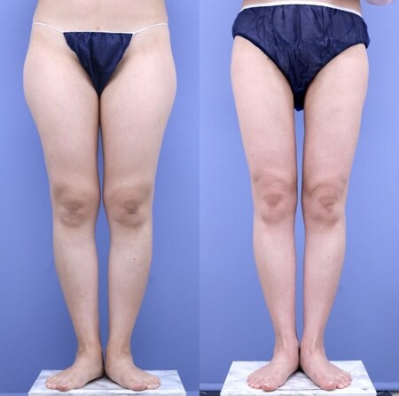 ベスト症例写真