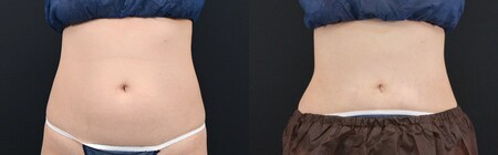 ベスト症例写真