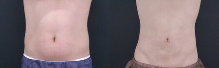 ベスト症例写真