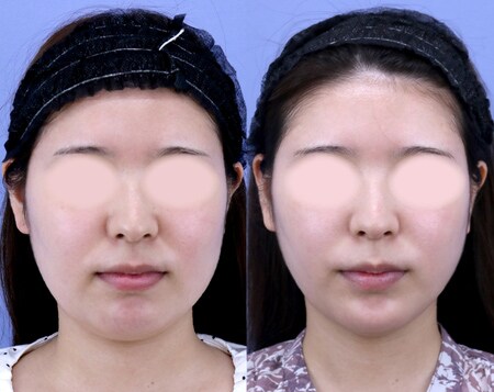 ベスト症例写真