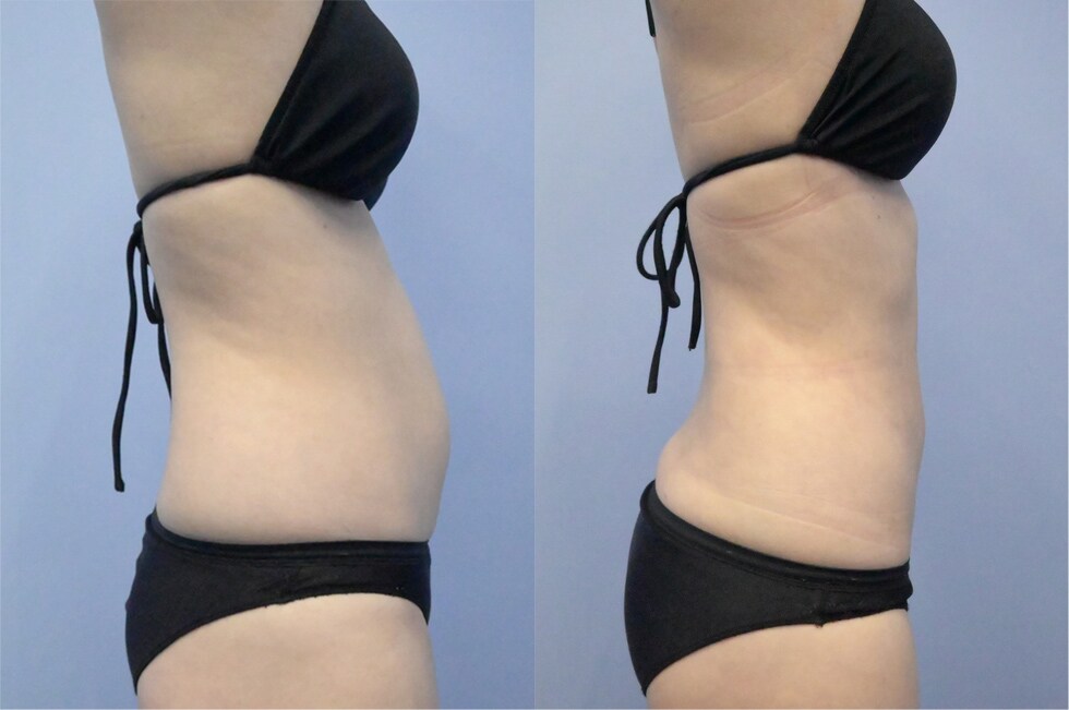 ベスト症例写真