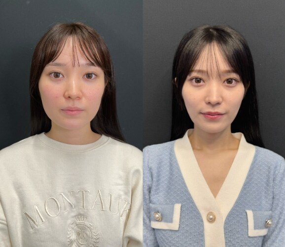 ベスト症例写真