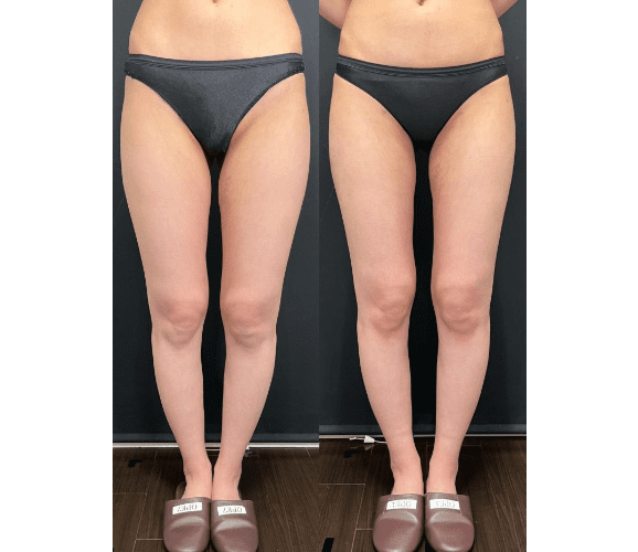 ベスト症例写真