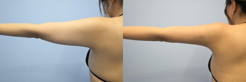 ベスト症例写真