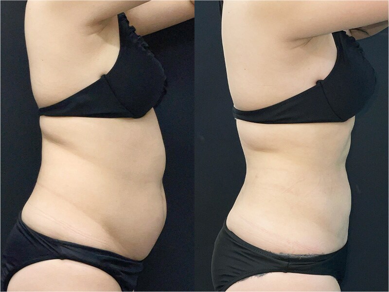 ベスト症例写真