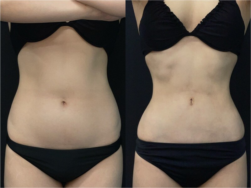 ベスト症例写真