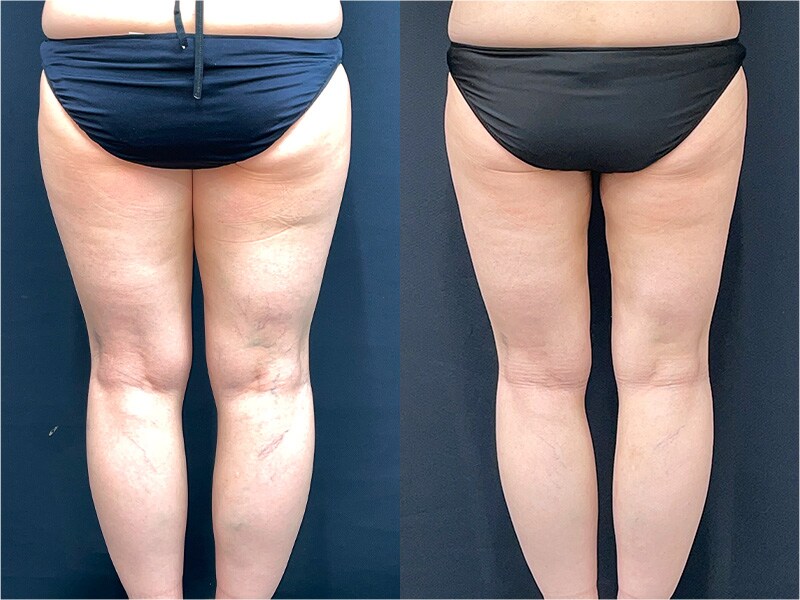 ベスト症例写真