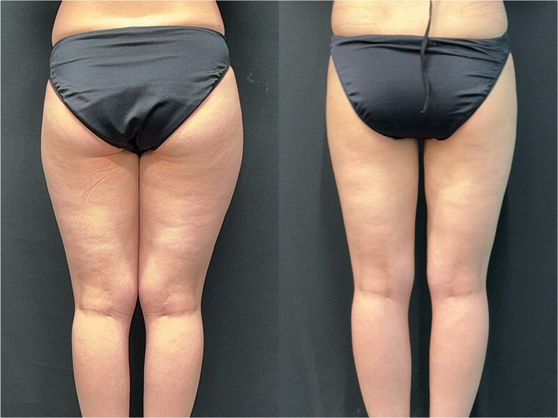 ベスト症例写真