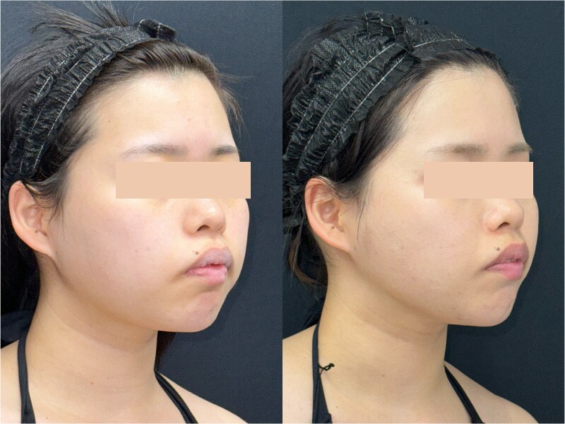 ベスト症例写真