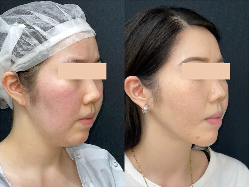 ベスト症例写真