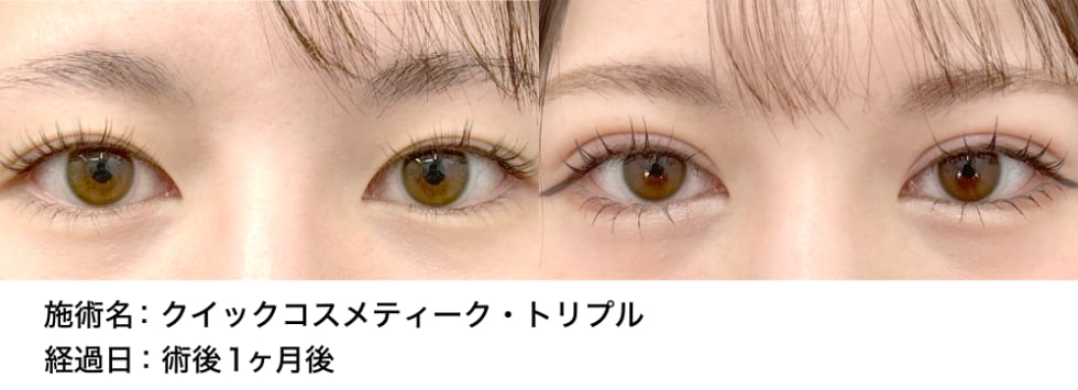 ベスト症例写真