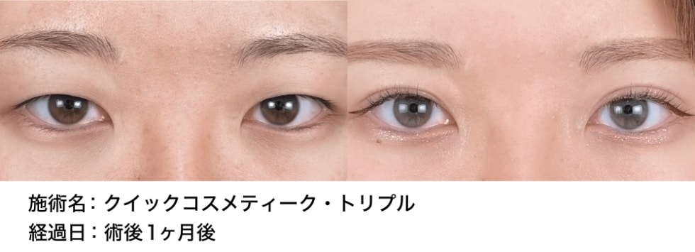 ベスト症例写真