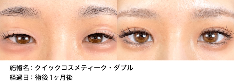 ベスト症例写真