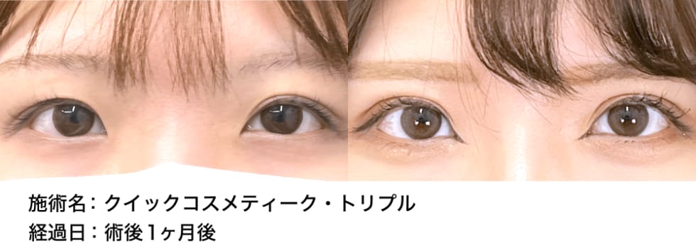 ベスト症例写真