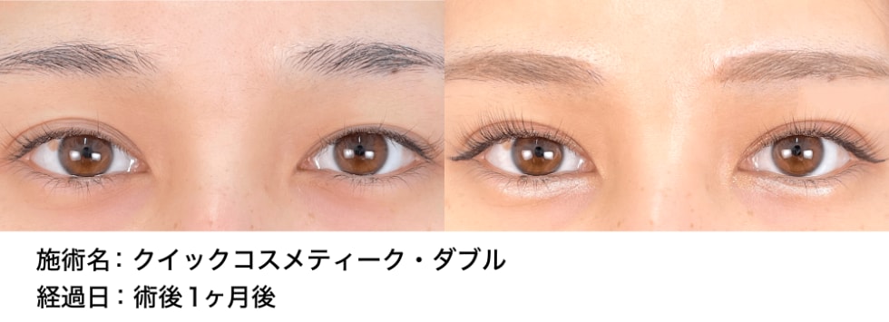 ベスト症例写真