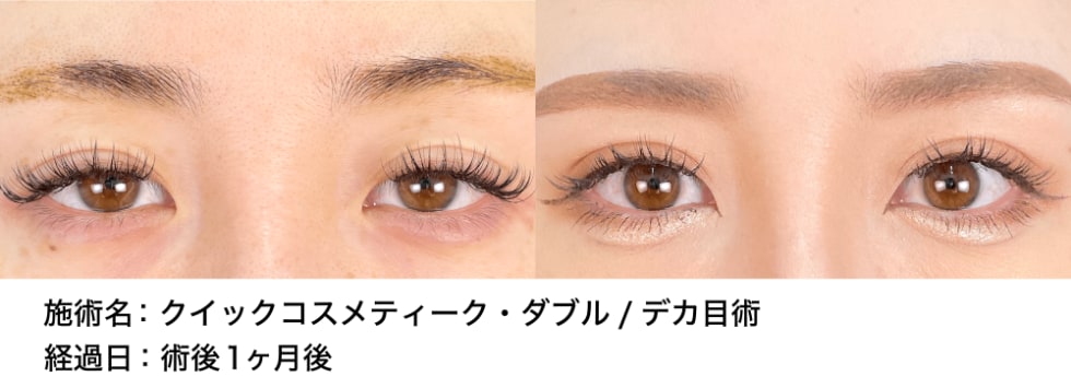 ベスト症例写真