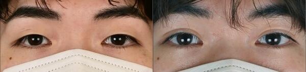 ベスト症例写真