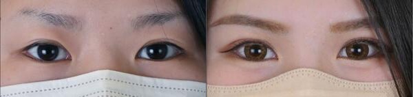 ベスト症例写真